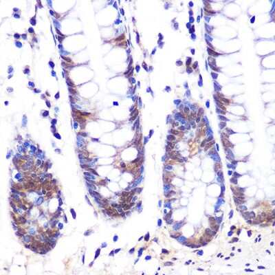 Immunohistochemistry-Paraffin: LXR alpha/NR1H3 Antibody (7Z4H10) [NBP3-16304]