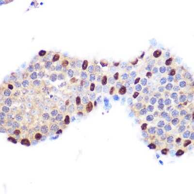 Immunohistochemistry-Paraffin: LXR alpha/NR1H3 Antibody (7Z4H10) [NBP3-16304]