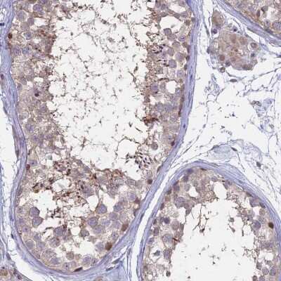 Immunohistochemistry-Paraffin: LXR alpha/NR1H3 Antibody [NBP1-92086]