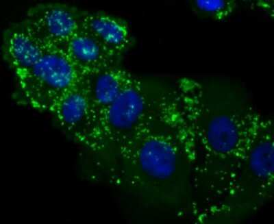 Immunocytochemistry/ Immunofluorescence: LXR alpha/NR1H3 Antibody (JA20-38) [NBP2-66938]