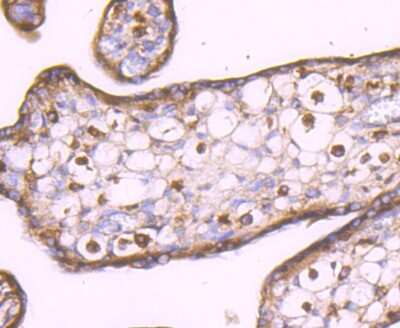 Immunohistochemistry-Paraffin: LXR alpha/NR1H3 Antibody (JA20-38) [NBP2-66938]
