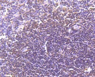 Immunohistochemistry-Paraffin: LXR alpha/NR1H3 Antibody (JA20-38) [NBP2-66938]