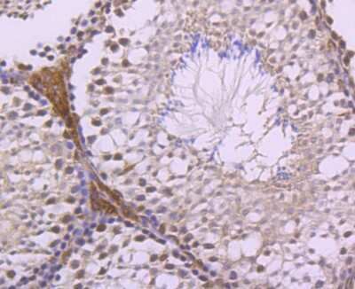 Immunohistochemistry-Paraffin: LXR alpha/NR1H3 Antibody (JA20-38) [NBP2-66938]