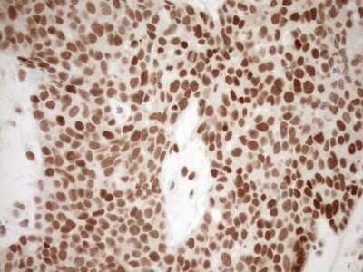 Immunohistochemistry: LXR alpha/NR1H3 Antibody (OTI1A5) - Azide and BSA Free [NBP2-72550]