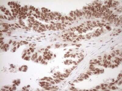 Immunohistochemistry: LXR alpha/NR1H3 Antibody (OTI1A5) - Azide and BSA Free [NBP2-72550]
