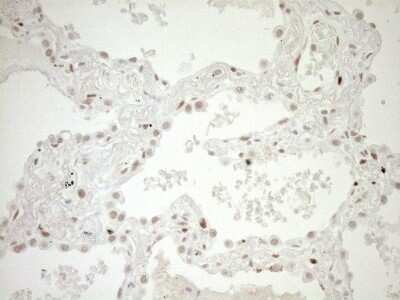 Immunohistochemistry: LXR alpha/NR1H3 Antibody (OTI1A5) - Azide and BSA Free [NBP2-72550]