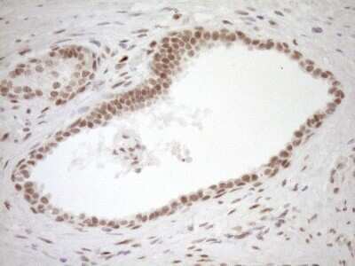 Immunohistochemistry: LXR alpha/NR1H3 Antibody (OTI1A5) - Azide and BSA Free [NBP2-72550]