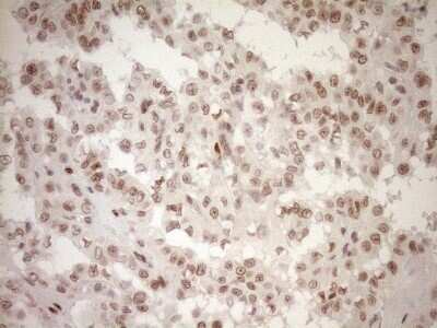 Immunohistochemistry: LXR alpha/NR1H3 Antibody (OTI1A5) - Azide and BSA Free [NBP2-72550]