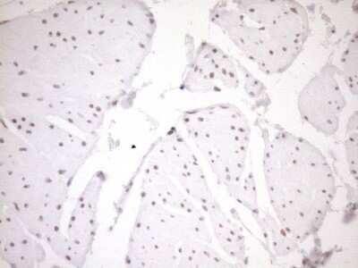 Immunohistochemistry: LXR alpha/NR1H3 Antibody (OTI1A5) - Azide and BSA Free [NBP2-72550]