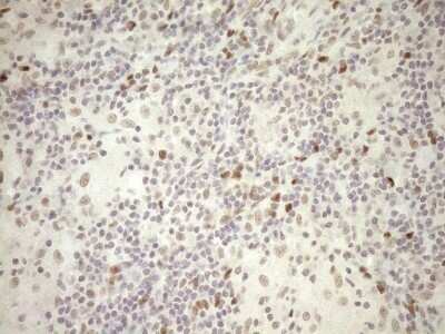 Immunohistochemistry: LXR alpha/NR1H3 Antibody (OTI1A5) - Azide and BSA Free [NBP2-72550]