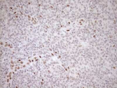 Immunohistochemistry: LXR alpha/NR1H3 Antibody (OTI1A5) - Azide and BSA Free [NBP2-72550]