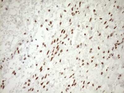 Immunohistochemistry: LXR alpha/NR1H3 Antibody (OTI1A5) - Azide and BSA Free [NBP2-72550]