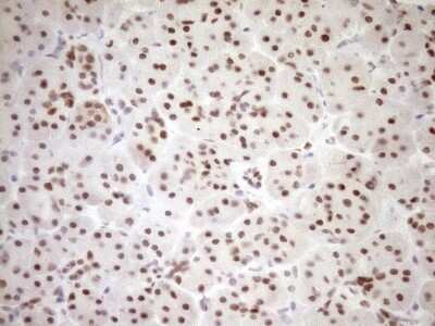 Immunohistochemistry: LXR alpha/NR1H3 Antibody (OTI1A5) - Azide and BSA Free [NBP2-72550]
