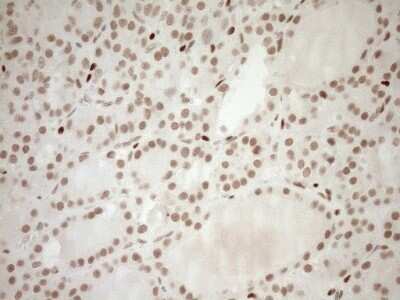 Immunohistochemistry: LXR alpha/NR1H3 Antibody (OTI1A5) - Azide and BSA Free [NBP2-72550]