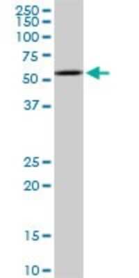 Western Blot: LXR beta/NR1H2 Antibody (1B6) [H00007376-M03]