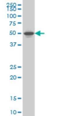 Western Blot: LXR beta/NR1H2 Antibody (1B6) [H00007376-M03]