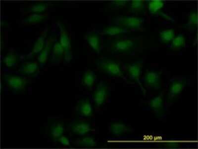 Immunocytochemistry/ Immunofluorescence: LXR beta/NR1H2 Antibody (1E1) [H00007376-M04]