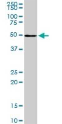 Western Blot: LXR beta/NR1H2 Antibody (1E1) [H00007376-M04]