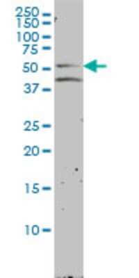 Western Blot: LXR beta/NR1H2 Antibody (2H2-H3) [H00007376-M01]