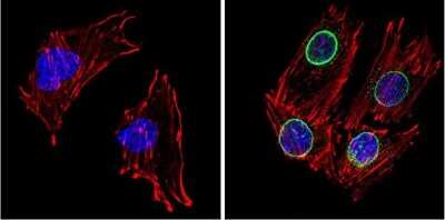 Immunocytochemistry/ Immunofluorescence: LXR beta/NR1H2 Antibody [NB100-74457]