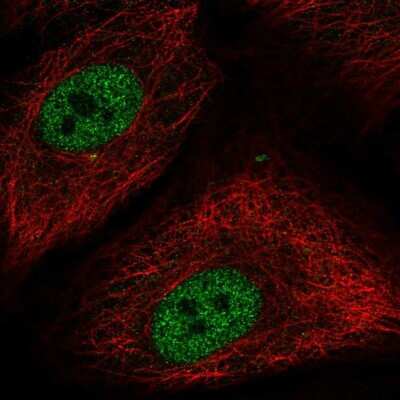 Immunocytochemistry/ Immunofluorescence: LXR beta/NR1H2 Antibody [NBP2-55918]