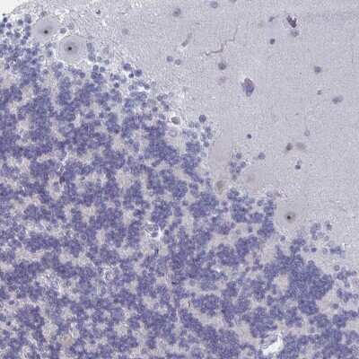 Immunohistochemistry-Paraffin: LXR beta/NR1H2 Antibody [NBP2-33801]