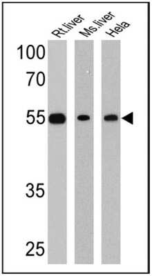Western Blot: LXR beta/NR1H2 Antibody [NB100-74457]