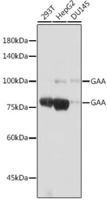 Western Blot: LYAG/GAA Antibody (5L2L10) [NBP3-15698]