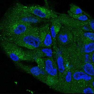 Immunocytochemistry/ Immunofluorescence: LYAG/GAA Antibody [NBP1-69295]