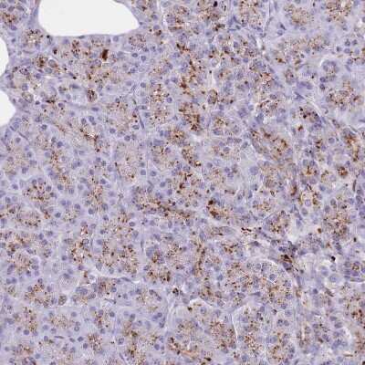 Immunohistochemistry-Paraffin: LYAG/GAA Antibody [NBP2-38142]