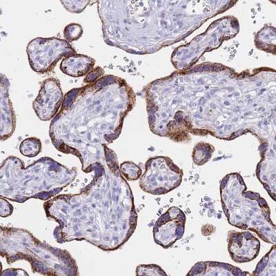 Immunohistochemistry-Paraffin: LYAG/GAA Antibody [NBP2-38142]