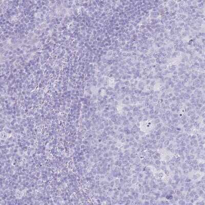 Immunohistochemistry-Paraffin: LYAG/GAA Antibody [NBP2-38142]
