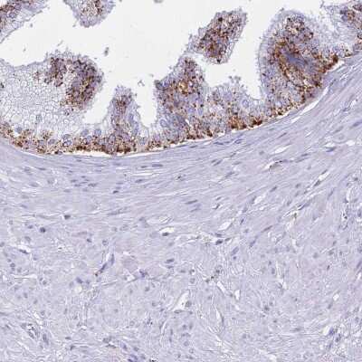 Immunohistochemistry-Paraffin: LYAG/GAA Antibody [NBP2-38142]
