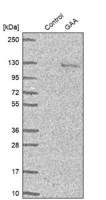 Western Blot: LYAG/GAA Antibody [NBP2-38142]