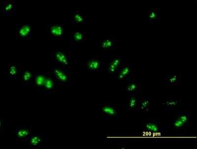 Immunocytochemistry/ Immunofluorescence: LYAR Antibody [H00055646-B01P]