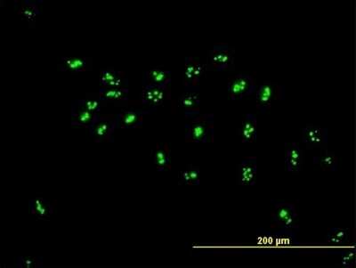 Immunocytochemistry/ Immunofluorescence: LYAR Antibody [H00055646-B02P]