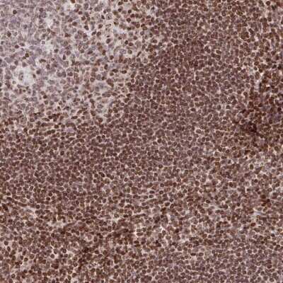 Immunohistochemistry-Paraffin: LYDG10 Antibody [NBP2-31849]