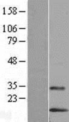 Western Blot: LYNX1 Overexpression Lysate [NBL1-12755]