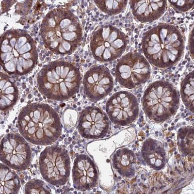 Immunohistochemistry-Paraffin: LYPD5 Antibody [NBP1-83549]
