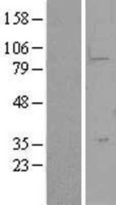 Western Blot: LYPD5 Overexpression Lysate [NBP2-10055]