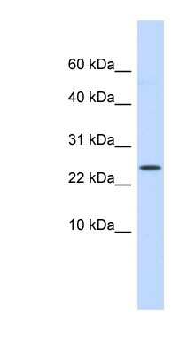Western Blot: LYPD6 Antibody [NBP1-70629]