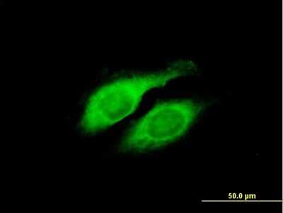 Immunocytochemistry/ Immunofluorescence: LYPLA2 Antibody [H00011313-B01P]