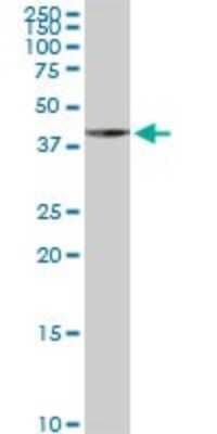Western Blot: LYPLA3 Antibody (3B11) [H00023659-M01]