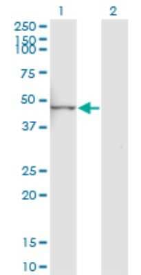 Western Blot: LYPLA3 Antibody (3B11) [H00023659-M01]