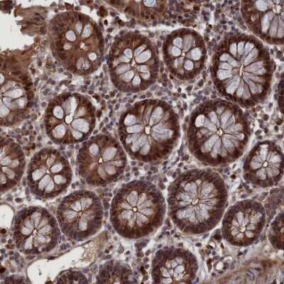 Immunohistochemistry-Paraffin: LYPLA3 Antibody [NBP1-92089]