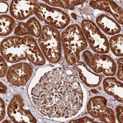 Immunohistochemistry-Paraffin: LYPLAL1 Antibody [NBP1-92090]