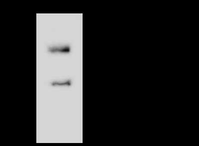 Immunoprecipitation: LYPLAL1 Antibody [NBP3-06252]