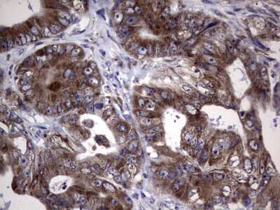 Immunohistochemistry: Metadherin Antibody (OTI1B6) [NBP2-46026]