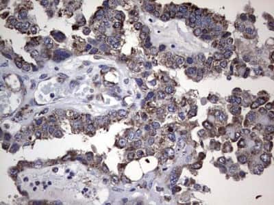 Immunohistochemistry: Metadherin Antibody (OTI1B6) [NBP2-46026]