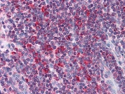 Immunohistochemistry-Paraffin: Metadherin Antibody (2F11C3) - BSA Free [NBP1-51585]